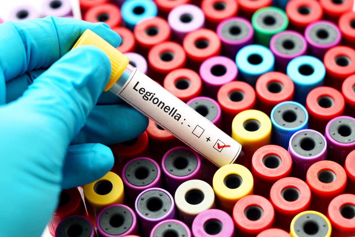 Libre istock legionella